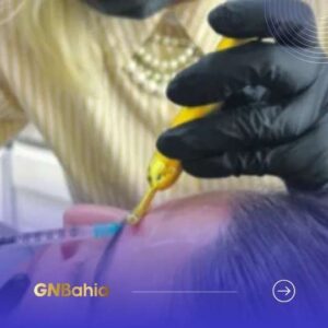 Cuidados no uso do botox evitam perda de dinheiro e problemas de saúde